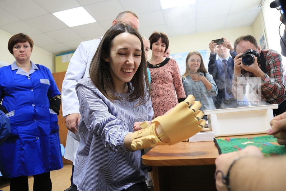 Уникальный протез кисти руки установили в Казани студентке